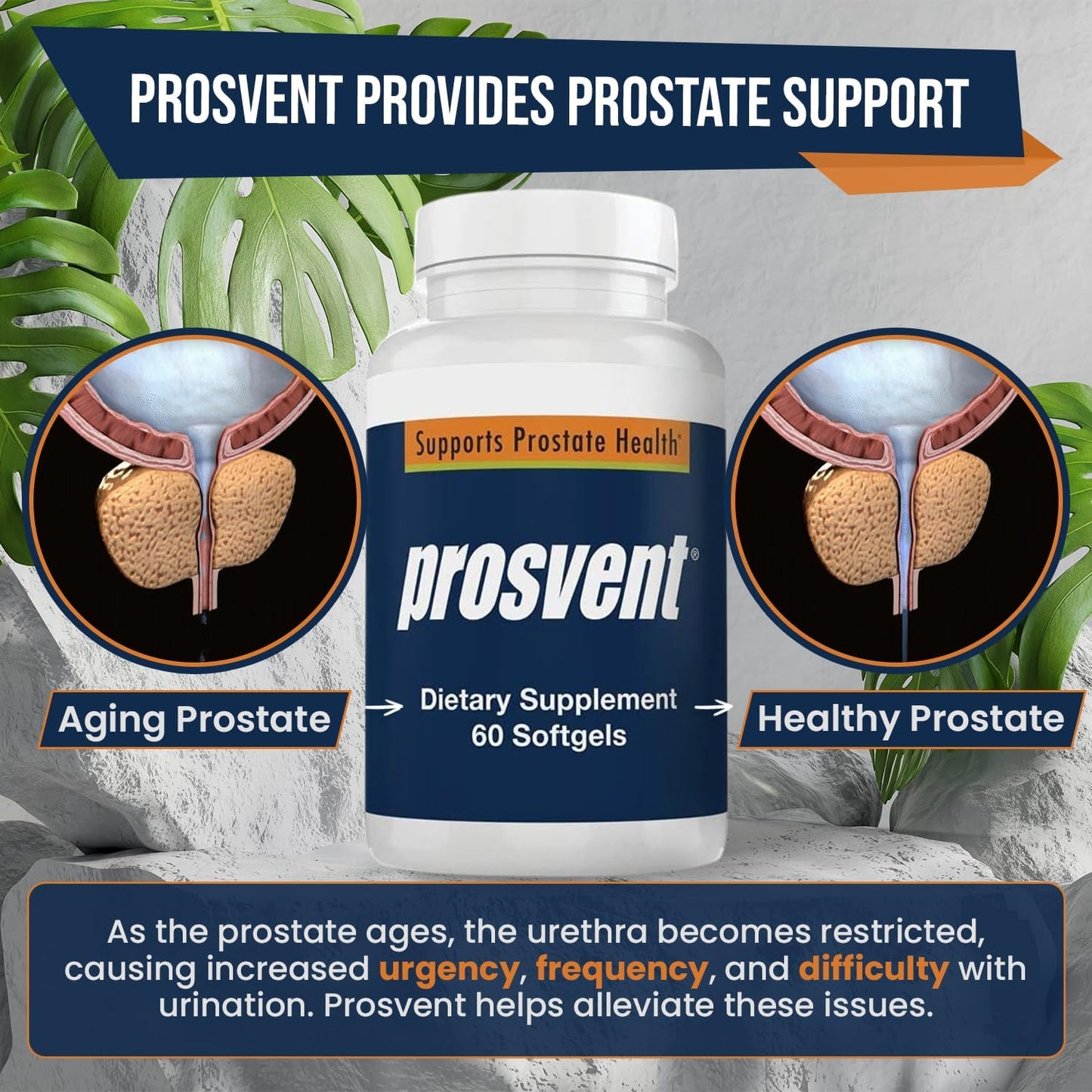 Prosvent Prostate Support with Beta Sitosterol & Stinging Nettle, 60 Ct