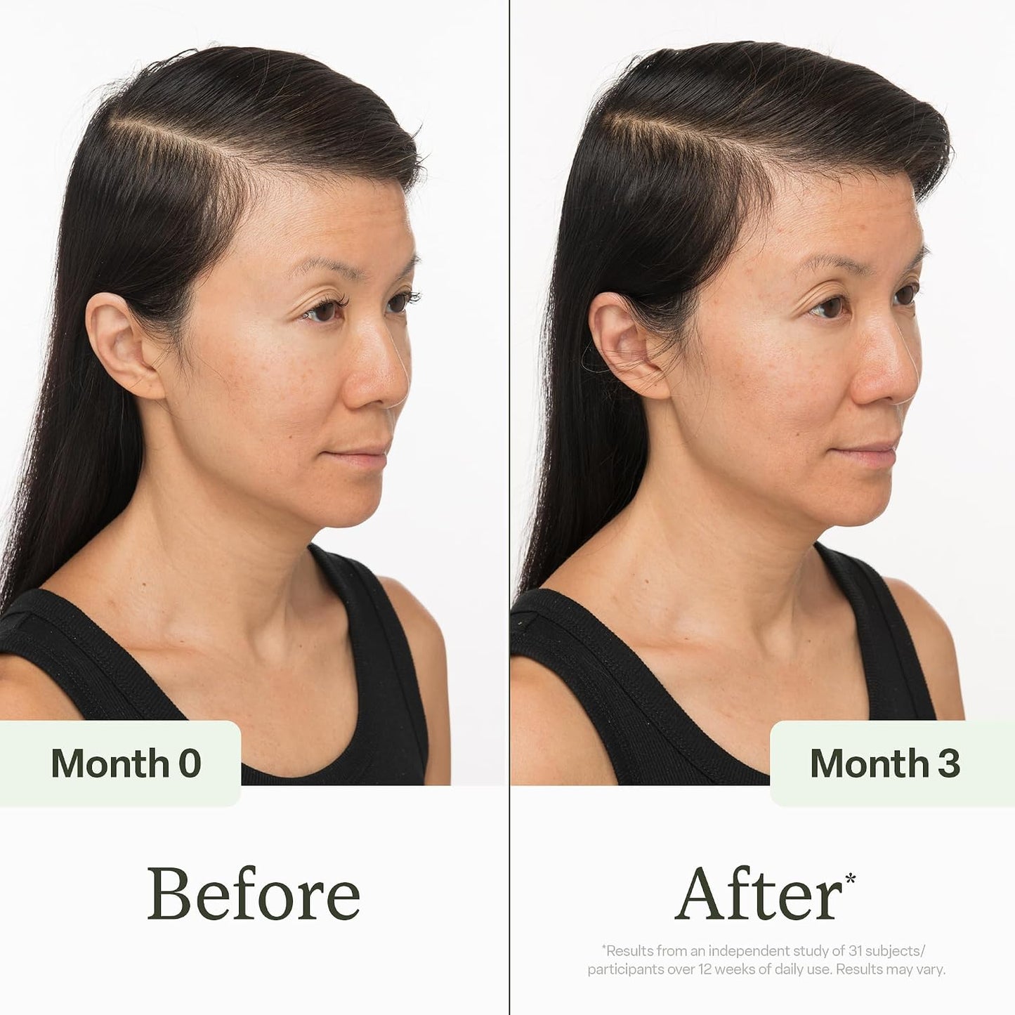 Divi Scalp Serum -30ml