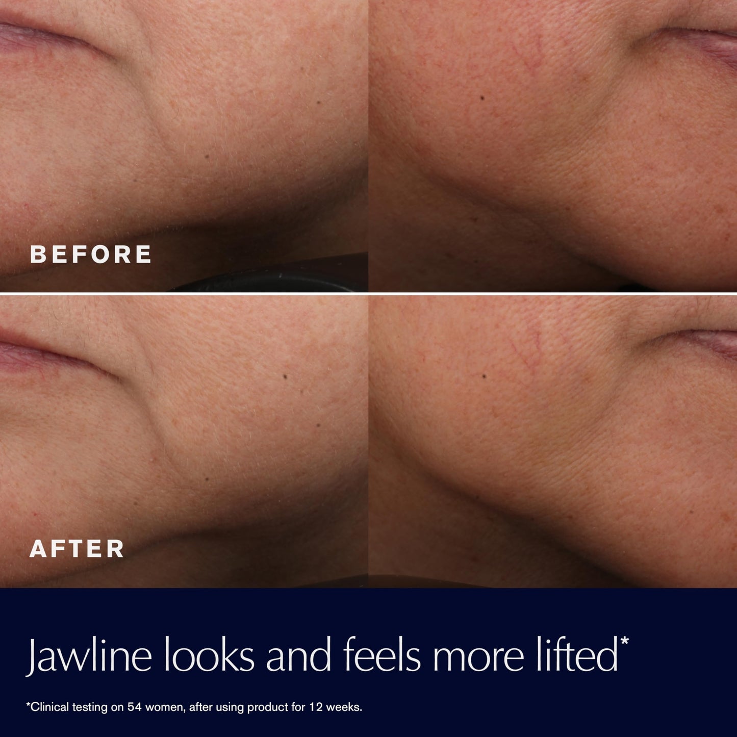 Estée Lauder Revitalizing Supreme+ hibiscus extract signals firmer look